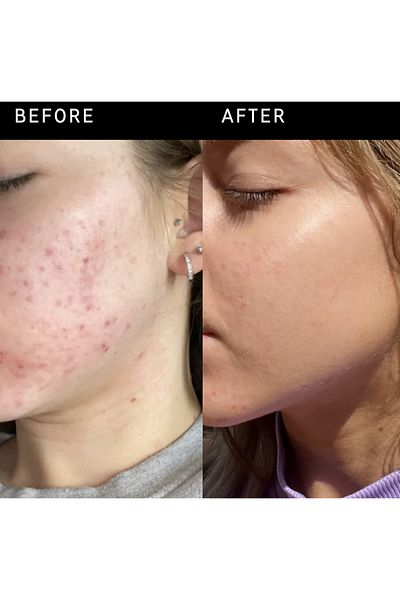 THE INKEY LIST Niacinamide - Serum