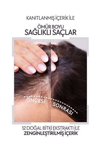 La Rachel Saç Dökülmesine Karşı Güçlü Koruma Ve Saç Büyümesini Destekleyen Doğal Bitki Özlü Şampuan