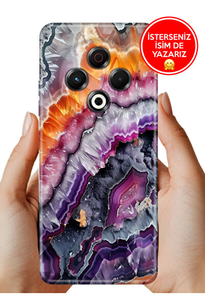 TECNO Spark 30 Kılıf Lüks Desenli Silikon Cover Case Kap Gizli Hazine