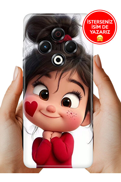 TECNO Spark 30 Kılıf Kamera Koruma Rubber Esnek Silikon Minnosh
