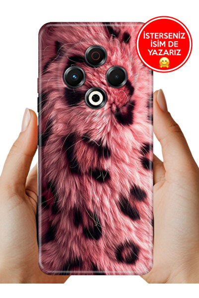 TECNO Spark 30 Kılıf Desenli Rubber Kamera Korumalı Silikon Pembe Çitah