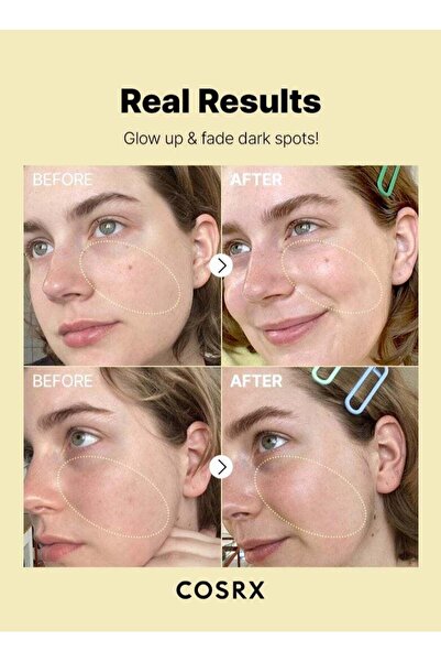 Cosrx Ultimate Skincare Arsenal & Face Massage Roller - Snail Cream, Retinol, Niacinamide Serum