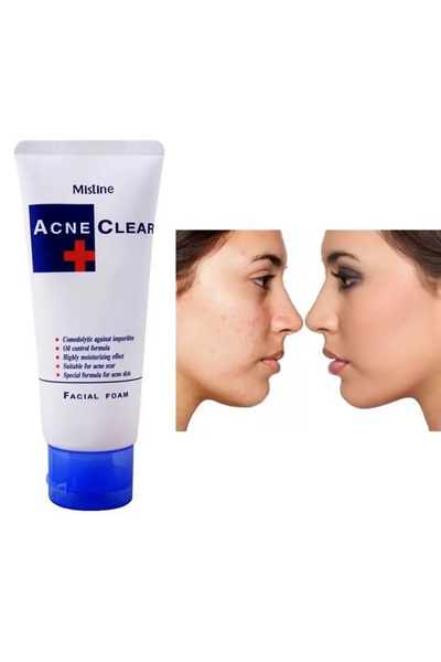 Mistine رغوة تنظيف الوجه لمكافحة حب الشباب 85 جرام ميستين التايلاندي