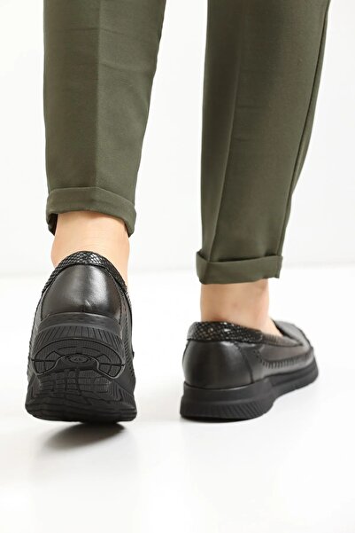 Forelli Genuine Leather Medical Orthopedic Women's Casual Shoes Special Soft Lambskin