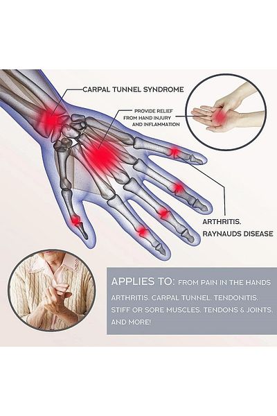 Choice L Hand 9-11cm 1Pair Copper Arthritis Gloves for Hand Pain Relief, Rheumatoid Osteoarthritis, Swellin