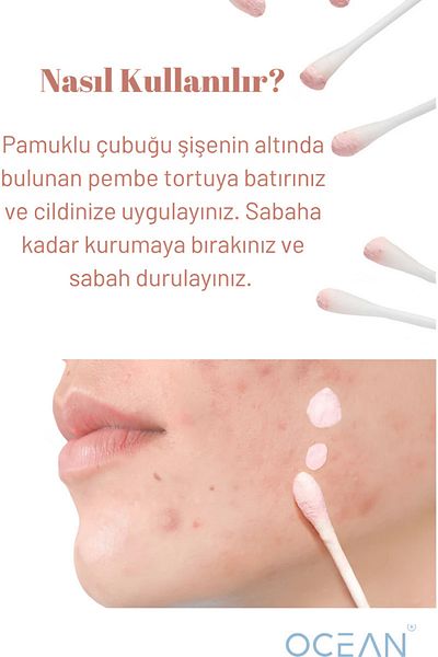 Ocean لوشن العناية المضاد لحب الشباب - لوشن مجفف