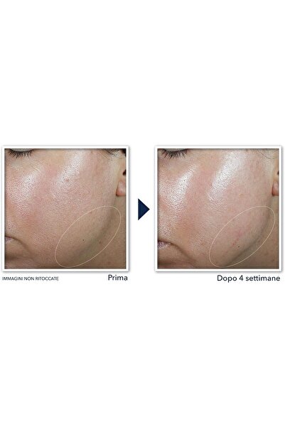 Roc Derm Correxion Contour Cream 50 ml