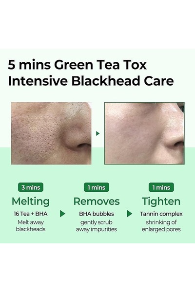Some By Mi Korean Bye Bye Blackhead 30 Days Miracle Green Tea Tox Bubble Cleanser - 120G