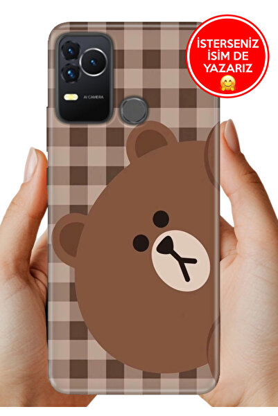 omix X400 Kılıf Desenli Baskılı Kamera Korumalı Silikon Ekose Bear