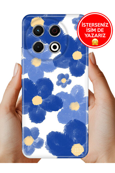 TECNO Spark 30 Pro KL7 Kılıf Trend Desenli Esnek Kapak Blue Orgin