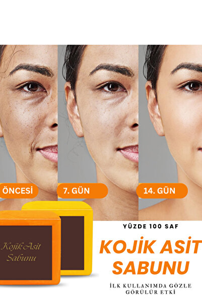 VERANT Yüksek Asit Oranlı Kojic Asit Sabunu (Zerdeçal Ve Kojik Asit) Leke Karşıtı Kojik Asit Sabunu