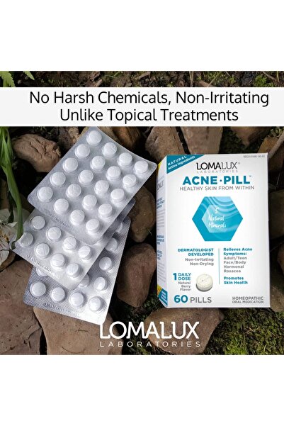 Loma Lux Natural Acne Pill with Zinc & Sulfur - Dermatologist Developed, Clears & Prevents Acne