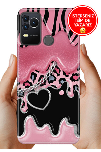 omix X400 Uyumlu Kılıf Rubber Esnek Silikon Tam Koruma Society Kalp