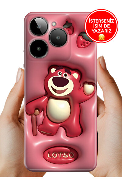 General Mobile Era 30 Kılıf Desenli Baskılı Kamera Korumalı Silikon Lotso