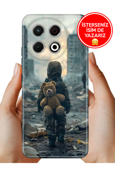 TECNO Spark 30 Pro KL7 Kılıf Rubber Esnek Silikon Tam Koruma Savaşa Hayır