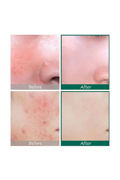 Some By Mi Some By Mi Aha Bha Pha Serum - 50ml