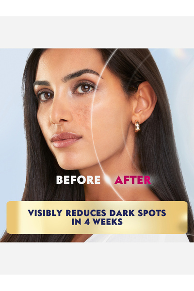 NIVEA Face Care Luminous Concentrated Serum 30ml (803016)