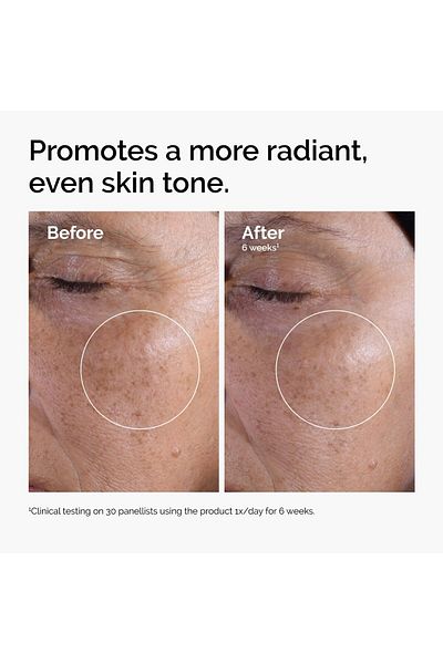 The Ordinary Glycolic Acid 7% Exfoliating Toner, Brightening & Smoothing for Even Skin Tone, 8.1 Fl Oz