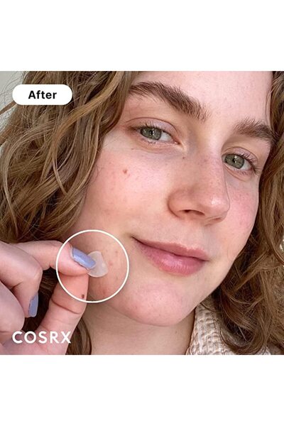 Cosrx Acne Pimple Master Patch - 24 Patches