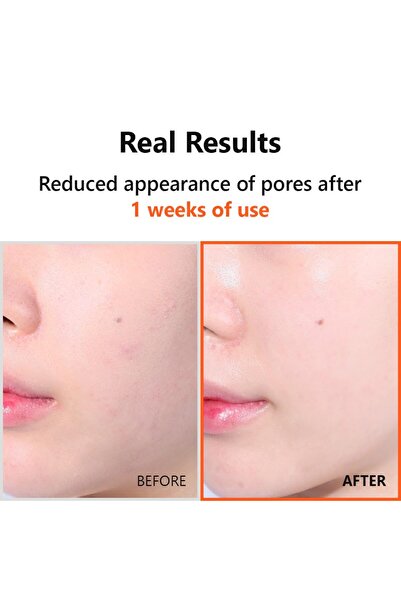 Isntree ISNTREE Hyper Niacinamide 20 Serum 20ml | 10x Hyaluronic Acid | Minimize Pores | Evens Skin Tone