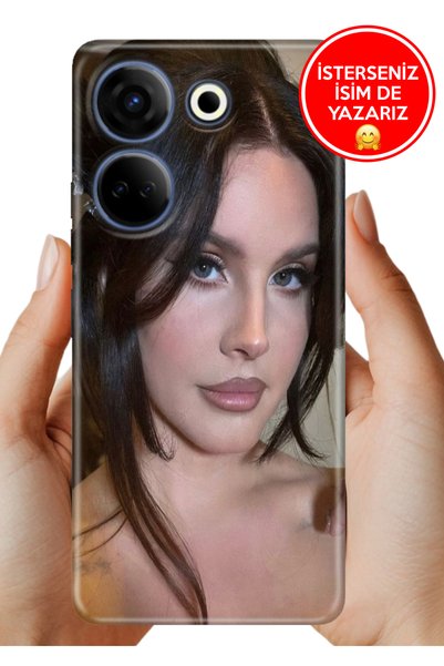 TECNO Camon 20 Pro 4G Kılıf Desenli Baskılı Kamera Korumalı Silikon Lana
