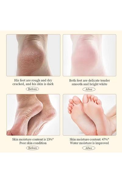 SADOER Shea Butter Hand and Foot Cream for Cracked Skin Repair 60g