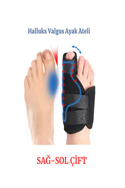 Ankaflex 1 Çift Ayak Ateli Medikal Halluks Valgus Gece Başparmak Ateli Ayak B...