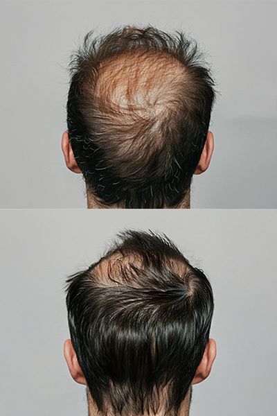 Reagain Anti-Hair Loss Natural Shampoo for Fine Hair 250ml