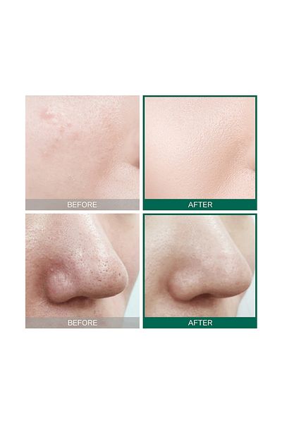 Some By Mi SOME BY MI AHA BHA PHA Skin Toner - 150ml