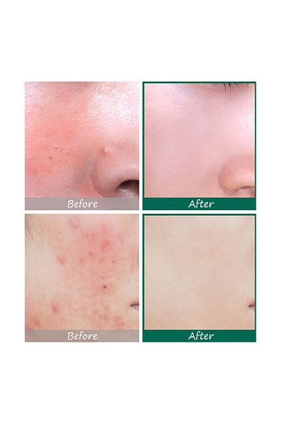 Some By Mi SOME BY MI AHA BHA PHA Serum 50ml