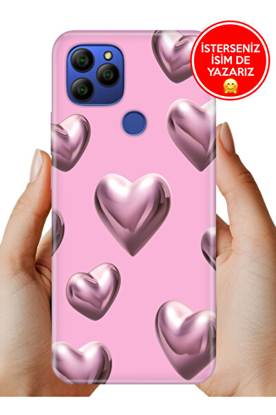 General Mobile GM 21 G310 Kılıf Desenli Rubber Kamera Korumalı Silikon Platin...