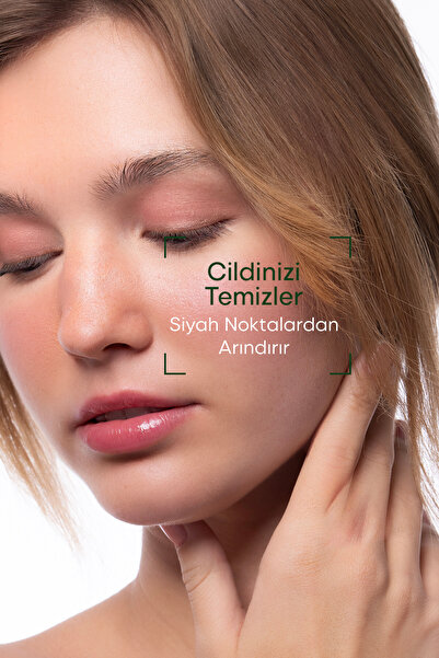 CALLİEL Siyah Nokta Karşıtı, Onarıcı Blackhead Bubble 120 Ml