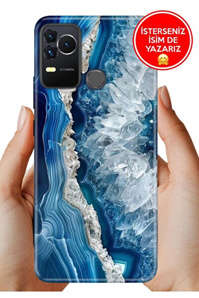 omix X400 Kılıf Desenli Baskılı Lens Korumalı Silikon OttoMarble