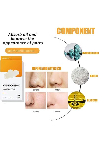 Kormesic Magic Whitehead Removal Strips Suction Pimples Acne Treatment Hydrocolloid Nose Patch Box