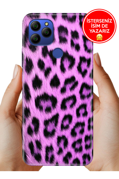 General Mobile GM 21 G310 Kılıf Desenli Baskılı Kamera Korumalı Silikon Mor Kürk