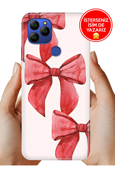 General Mobile GM 21 G310 Kılıf Kamera Korumalı Full Desen Arka Silikon Kurde...