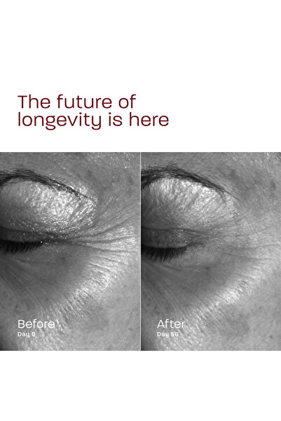 MORPHIYA Intensive Treatment Yaşlanma Karşıtı Biyoteknolojik Cilt Onarıcı Ve Iyileştirici Krem 30ml