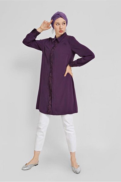 Alvina Güpür Detail Tunic 41783