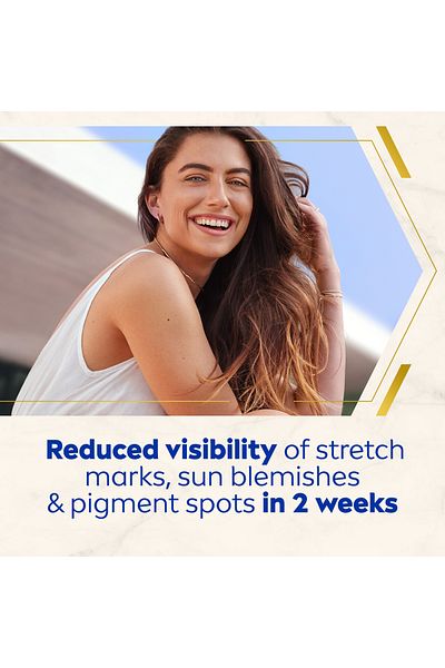 NIVEA LUMINOUS630 Stretch Marks Reduction Body Oil-Serum, 100ml
