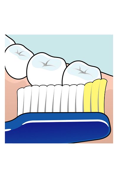 TePe Diş Fırçası Nova X-soft