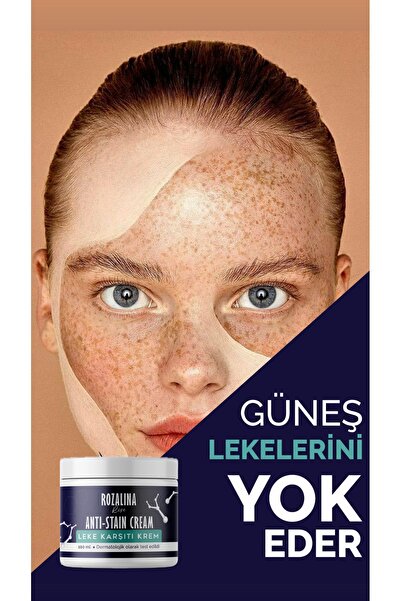 Rozalina Rise Leke,giderici Koltuk Altı-diz-dirsek Ve Bikini Bölgesi Cilt Bey...