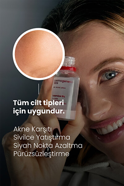 Cosmogenesis Labs Acne Önleyici Kurutucu Losyon 30ml – Yatıştırıcı Siyah Nokta Azaltıcı Vegan (%5 KALAMİN - YEŞİL ÇAY)