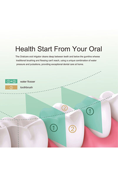 sharpdo Portable Cordless Water Dental Flosser with 4 Jet Tips, 5 Modes