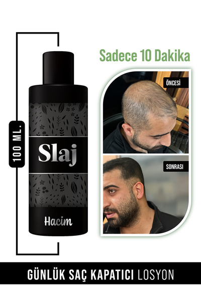 Seyrek Saç Kapatıcı Sıvı Topik 100 Ml. - Saç Fiberi Değildir - Anında Dolgun Ve Hacimli Saçlar