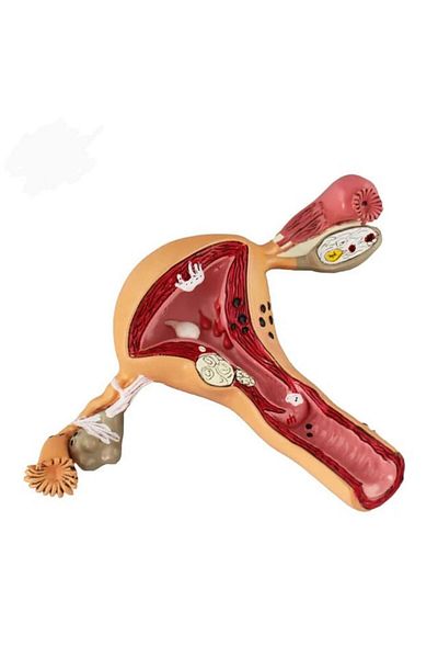 Naturachi Uterus Pelvic Floor Model 41