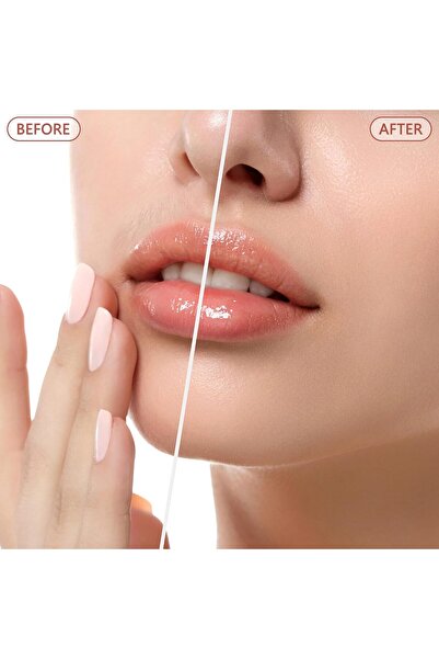Arabest Facial Hair Remover for Women -Painless Face Shaver - Electric Hair Removal Device with Light White