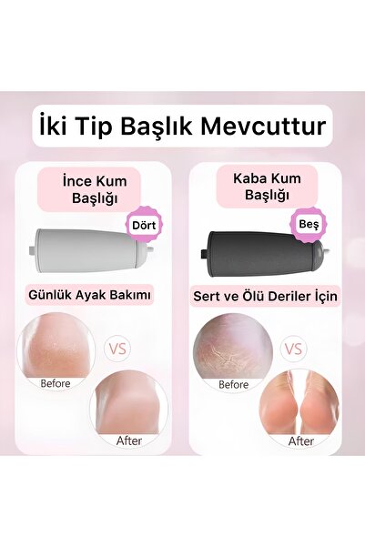 Lazım Shop Elektrikli Ayak Törpüsü Şarj Edilebilir Çıkartma Ayak Değirmeni