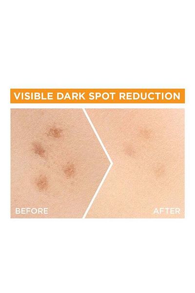 Garnier Garnier Fast Bright 30x Vitamin C Anti-Dark Spot Serum - 30ml