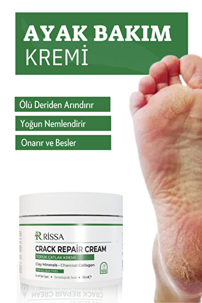 Rissa Ayak, Topuk, Çatlak, Mantar, Koku, Ve Diyabetik Yaralar Için Nemlendiri...