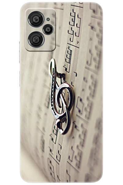 CASPER Via X30 / X30 PLUS Uyumlu Kılıf Desen Baskılı Silikon Sol Anahtarı STK...